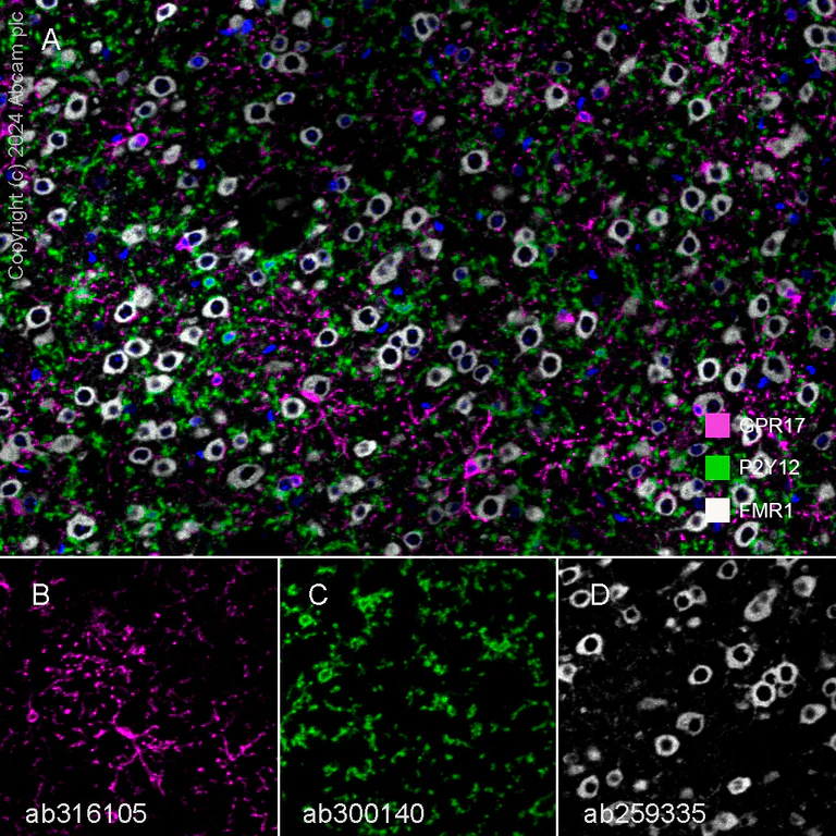 Multiplex immunohistochemistry - Anti-GPCR GPR17 antibody [EPR26423-34] - BSA and Azide free (AB316106)
