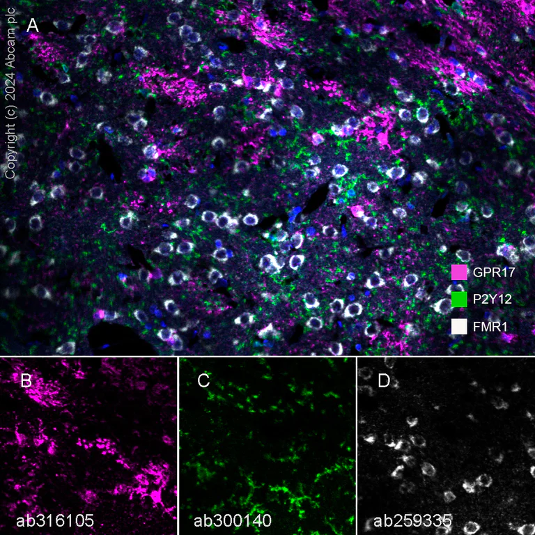 Multiplex immunohistochemistry - Anti-GPCR GPR17 antibody [EPR26423-34] - BSA and Azide free (AB316106)