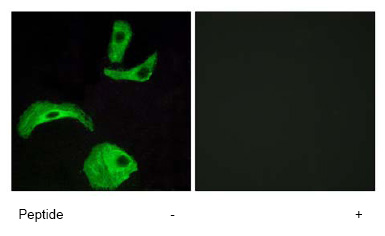 Immunocytochemistry/ Immunofluorescence - Anti-GPCR GPR18 antibody (AB76258), expandable thumbnail