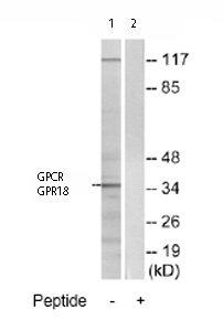 Western blot - Anti-GPCR GPR18 antibody (AB76258), expandable thumbnail