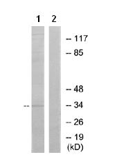 Western blot - Anti-GPCR GPR31 antibody (AB75579)