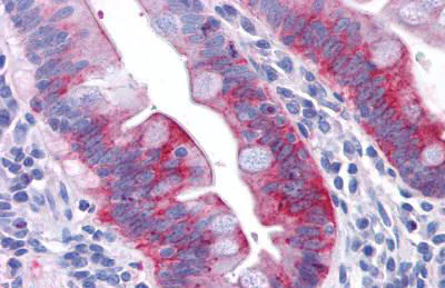 Immunohistochemistry (Formalin/PFA-fixed paraffin-embedded sections) - Anti-GPCR GPR31 antibody - Extracellular domain (AB150633)