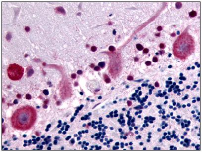 Immunohistochemistry (Formalin/PFA-fixed paraffin-embedded sections) - Anti-GPCR GPR32 antibody (AB61429), expandable thumbnail