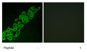 Immunocytochemistry/ Immunofluorescence - Anti-GPCR GPR32 antibody (AB79516)