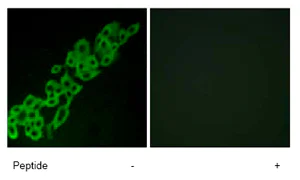 Immunocytochemistry/ Immunofluorescence - Anti-GPCR GPR32 antibody (AB79516)