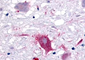 Immunohistochemistry (Formalin/PFA-fixed paraffin-embedded sections) - Anti-GPCR GPR32 antibody - Extracellular domain (AB150642)