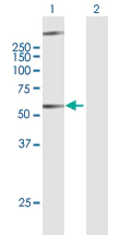 Western blot - Anti-GPCR GPR34 antibody (AB169455)