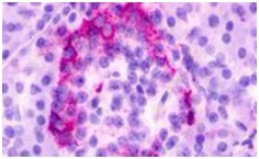 Immunohistochemistry (Formalin/PFA-fixed paraffin-embedded sections) - Anti-GPCR GPR35 antibody - Cytoplasmic domain (AB188949)