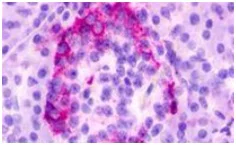 Immunohistochemistry (Formalin/PFA-fixed paraffin-embedded sections) - Anti-GPCR GPR35 antibody - Cytoplasmic domain (AB188949)