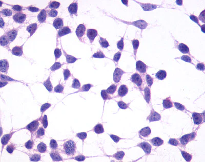 Immunocytochemistry - Anti-GPCR GPR4 antibody - C-terminal (AB188931)