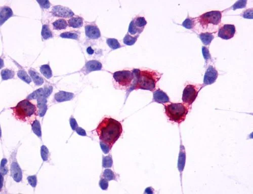 Immunocytochemistry - Anti-GPCR GPR4 antibody - C-terminal (AB188931)