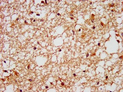 Immunohistochemistry (Formalin/PFA-fixed paraffin-embedded sections) - Anti-GPCR GPR40 antibody (AB236285)