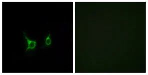 Immunocytochemistry/ Immunofluorescence - Anti-GPCR GPR43 antibody (AB124272)