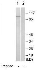 Western blot - Anti-GPCR GPR48/LGR4 antibody (AB75501), expandable thumbnail