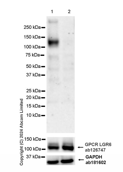Western blot - Anti-GPCR GPR48/LGR4 antibody [EPR26351-175] (AB321789), expandable thumbnail