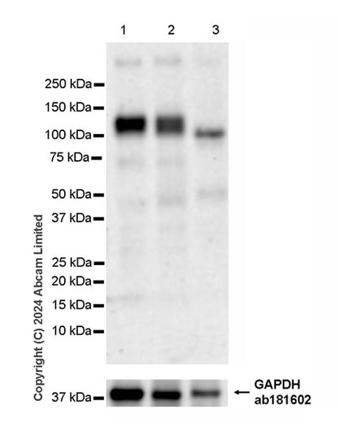 Western blot - Anti-GPCR GPR48/LGR4 antibody [EPR26351-175] (AB321789), expandable thumbnail