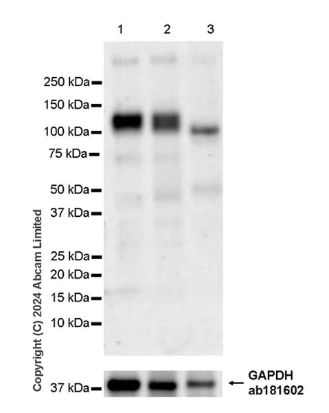 Western blot - Anti-GPCR GPR48/LGR4 antibody [EPR26351-175] (AB321789)