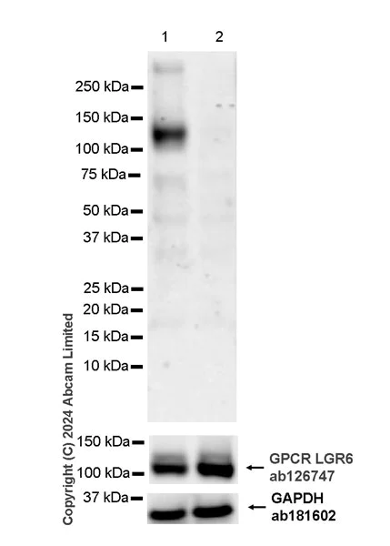 Western blot - Anti-GPCR GPR48/LGR4 antibody [EPR26351-175] - BSA and Azide free (AB321790)