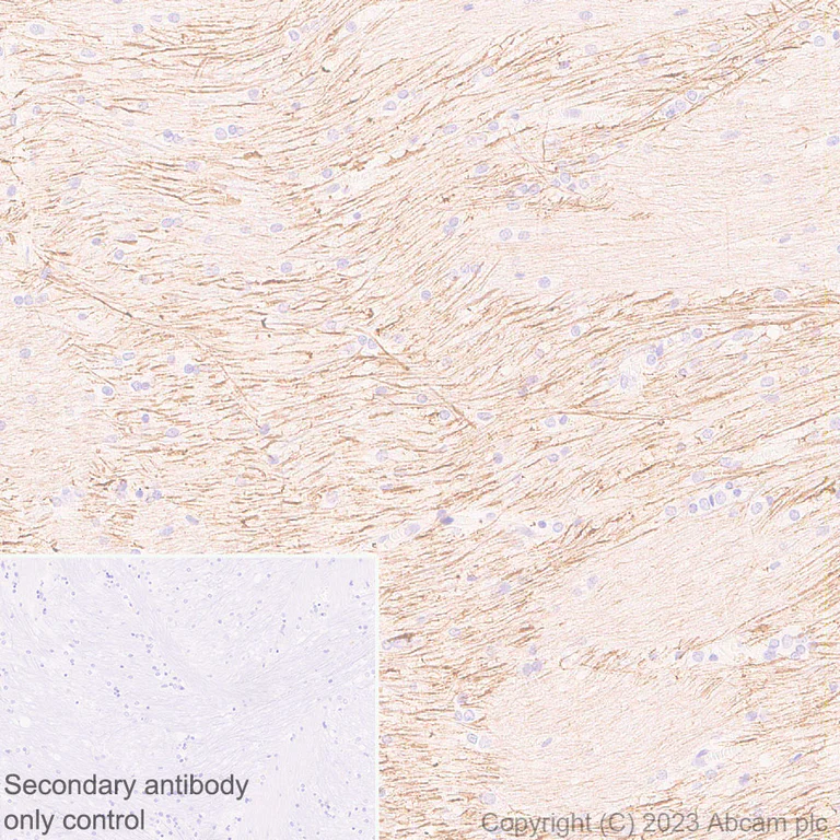 Immunohistochemistry (Formalin/PFA-fixed paraffin-embedded sections) - Anti-GPCR GPR52 antibody [EPR24344-51] (AB315438)
