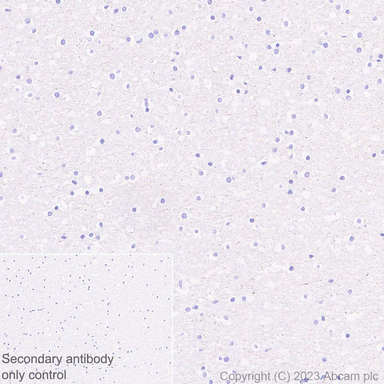 Immunohistochemistry (Formalin/PFA-fixed paraffin-embedded sections) - Anti-GPCR GPR52 antibody [EPR24344-51] (AB315438)