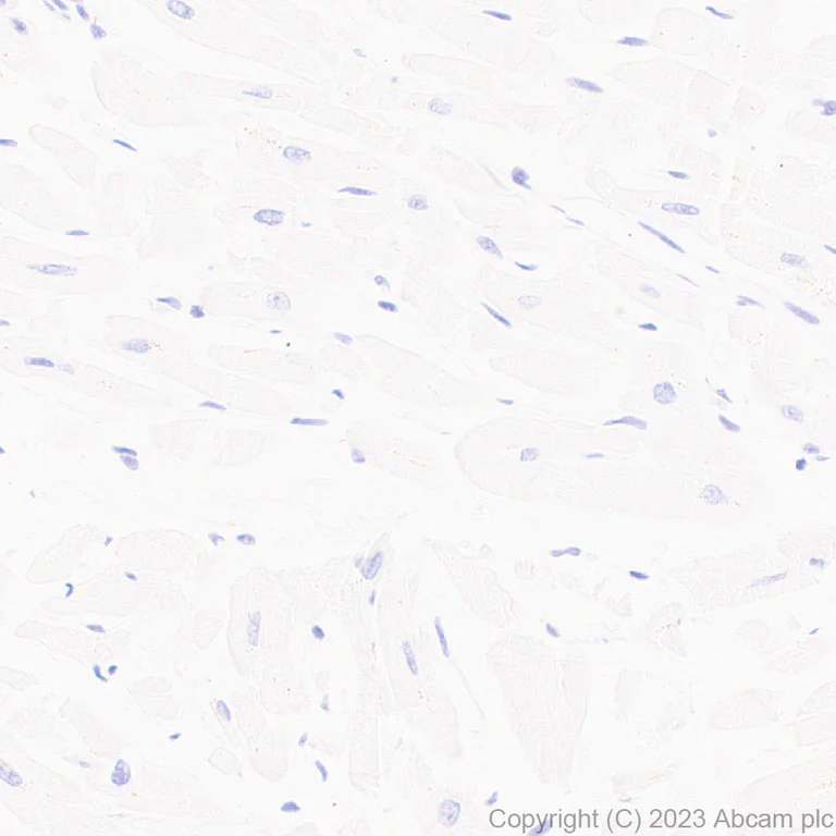 Immunohistochemistry (Formalin/PFA-fixed paraffin-embedded sections) - Anti-GPCR GPR52 antibody [EPR24344-51] (AB315438)