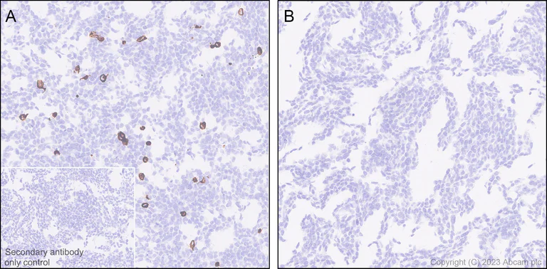 Immunohistochemistry (Formalin/PFA-fixed paraffin-embedded sections) - Anti-GPCR GPR52 antibody [EPR24344-51] (AB315438)