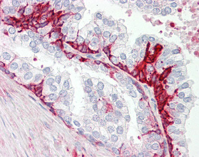 Immunohistochemistry (Formalin/PFA-fixed paraffin-embedded sections) - Anti-GPCR GPR55 antibody - C-terminal (AB174700)