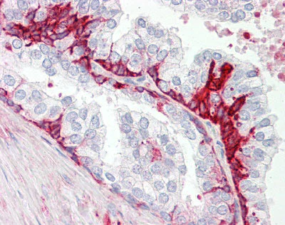 Immunohistochemistry (Formalin/PFA-fixed paraffin-embedded sections) - Anti-GPCR GPR55 antibody - C-terminal (AB174700)