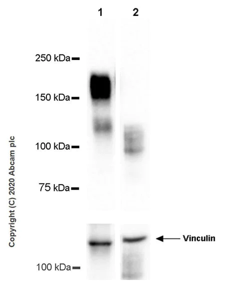 Western blot - Anti-GPCR GPR64 antibody [EPR23658-2] (AB272390)
