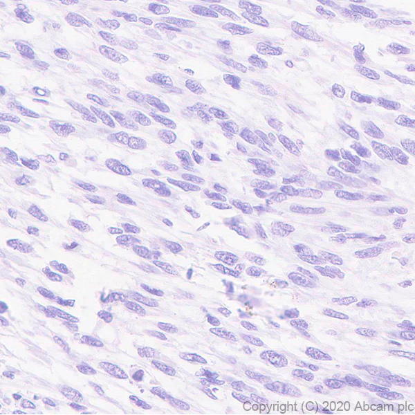 Immunohistochemistry (Formalin/PFA-fixed paraffin-embedded sections) - Anti-GPCR GPR64 antibody [EPR23658-2] - BSA and Azide free (AB272395)