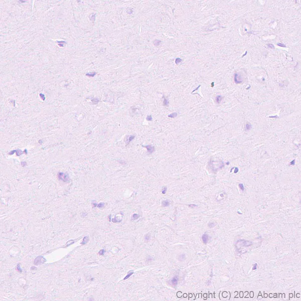 Immunohistochemistry (Formalin/PFA-fixed paraffin-embedded sections) - Anti-GPCR GPR64 antibody [EPR23658-2] - BSA and Azide free (AB272395)