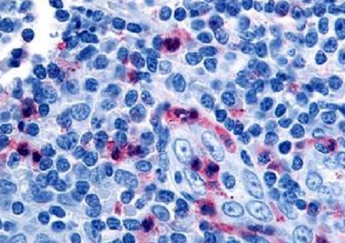 Immunohistochemistry (Formalin/PFA-fixed paraffin-embedded sections) - Anti-GPCR GPR65/TDAG8 antibody (AB188907)