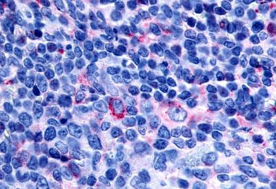 Immunohistochemistry (Formalin/PFA-fixed paraffin-embedded sections) - Anti-GPCR GPR65/TDAG8 antibody (AB188907)