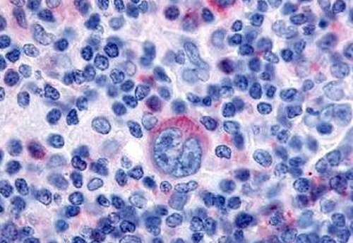 Immunohistochemistry (Formalin/PFA-fixed paraffin-embedded sections) - Anti-GPCR GPR65/TDAG8 antibody (AB188907)