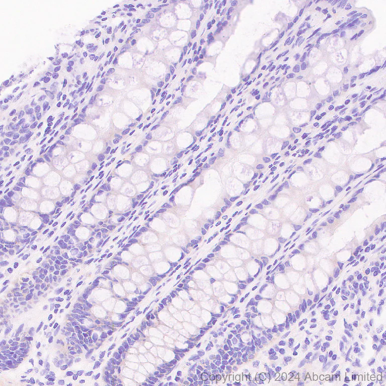 Immunohistochemistry (Formalin/PFA-fixed paraffin-embedded sections) - Anti-GPCR GPR75 antibody [EPR29107-69] (AB320084)
