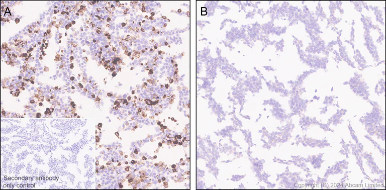 Immunohistochemistry (Formalin/PFA-fixed paraffin-embedded sections) - Anti-GPCR GPR75 antibody [EPR29107-69] (AB320084)