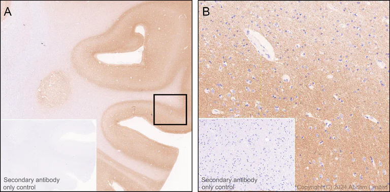 Immunohistochemistry (Formalin/PFA-fixed paraffin-embedded sections) - Anti-GPCR GPR75 antibody [EPR29107-69] (AB320084)