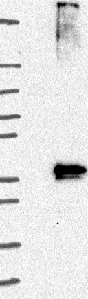 Western blot - Anti-GPCR GPR78 antibody (AB121390), expandable thumbnail