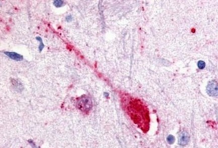 Immunohistochemistry (Formalin/PFA-fixed paraffin-embedded sections) - Anti-GPCR GPR85 antibody - Extracellular domain (AB140783)