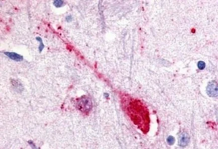 Immunohistochemistry (Formalin/PFA-fixed paraffin-embedded sections) - Anti-GPCR GPR85 antibody - Extracellular domain (AB140783)