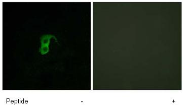 Immunocytochemistry/ Immunofluorescence - Anti-GPCR GPR87 antibody (AB77517), expandable thumbnail