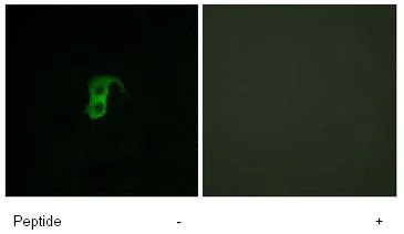 Immunocytochemistry/ Immunofluorescence - Anti-GPCR GPR87 antibody (AB77517)