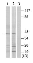 Western blot - Anti-GPCR GPR87 antibody (AB77517), expandable thumbnail