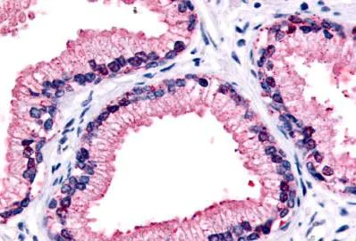 Immunohistochemistry (Formalin/PFA-fixed paraffin-embedded sections) - Anti-GPCR GPR87 antibody - C-terminal (AB188901)