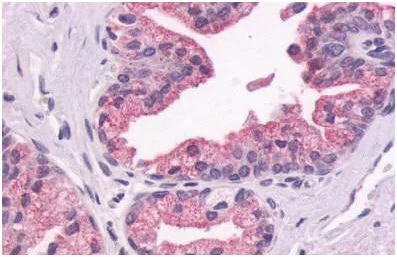 Immunohistochemistry (Formalin/PFA-fixed paraffin-embedded sections) - Anti-GPCR GPR87 antibody - N-terminal (AB140763)