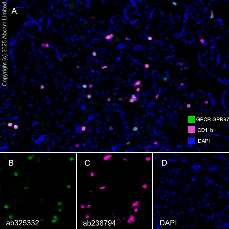 Multiplex immunohistochemistry - Anti-GPCR GPR97 antibody [EPR30227-586] (AB325332)