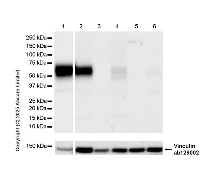 Western blot - Anti-GPCR GPR97 antibody [RM2090] (AB325346)