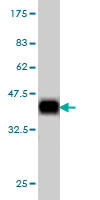 Western blot - Anti-GPCR GPRC5D antibody [6D9] - BSA and Azide free (AB55044)
