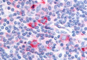 Immunohistochemistry (Formalin/PFA-fixed paraffin-embedded sections) - Anti-GPCR GPRC5D antibody - Cytoplasmic domain (AB188745)