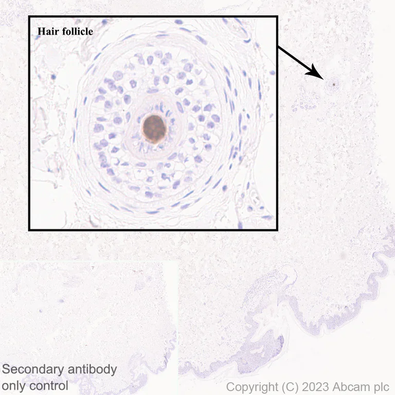 Immunohistochemistry (Formalin/PFA-fixed paraffin-embedded sections) - Anti-GPCR GPRC5D antibody [EPR28376-41] (AB315808)